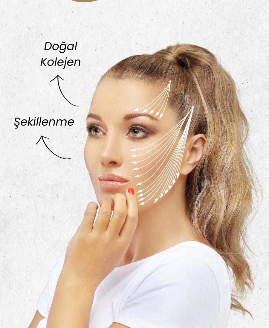 Fransız askı uygulaması